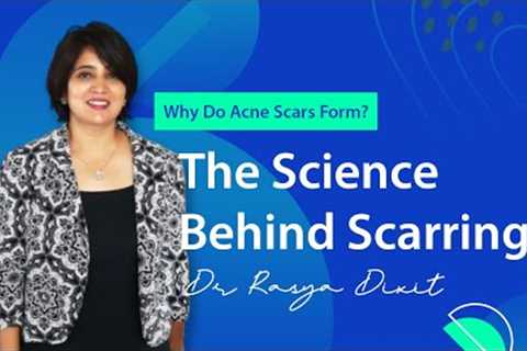 Healing Acne Scars Fast: The Complete Guide