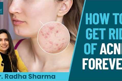 Different kinds of Acne and How to Treat Them Right ✅ | Dr. Radha Sharma