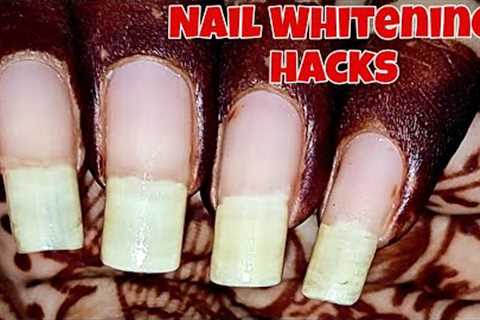 Grow & whiten your nails following these tips || Nail care & whitening hack by Nail..