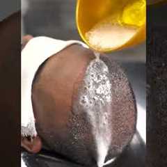 Expert Tips for First Shampoo After Hair Transplant | Cara Clinic